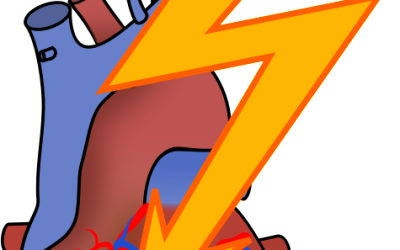 Should I take a statin?